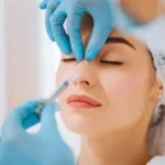 rhinoplastie tunisie prix 150x150
